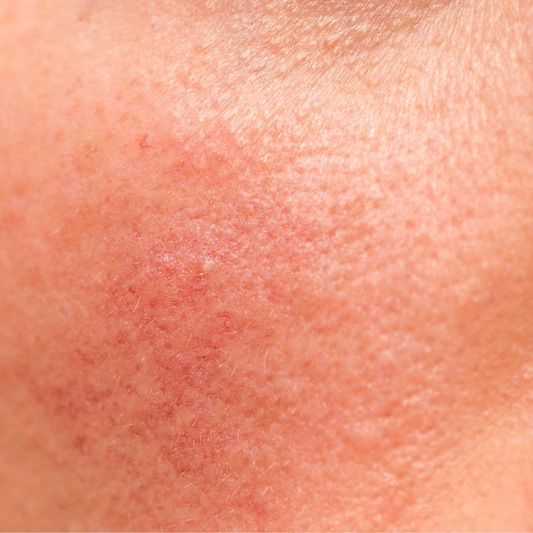 Strengthen Your Skin Barrier with Tallow + Jojoba