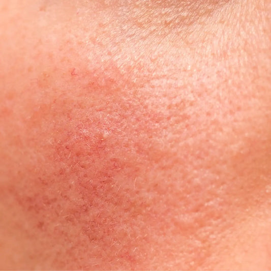 Strengthen Your Skin Barrier with Tallow + Jojoba