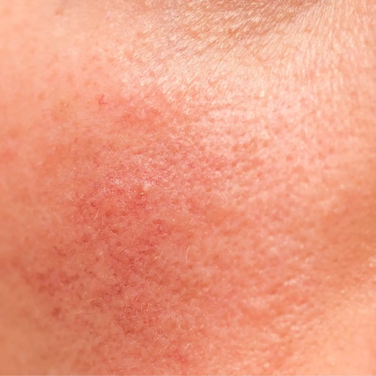 Strengthen Your Skin Barrier with Tallow + Jojoba